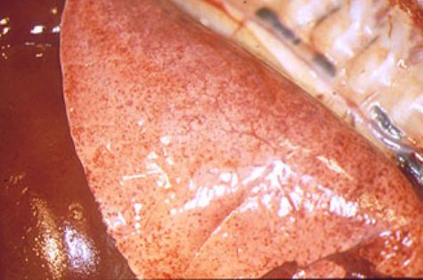 Hemorragias pulmonares