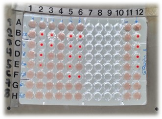Fijación del complemento
