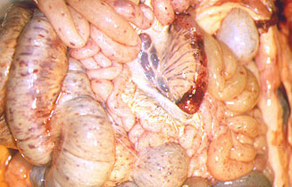 Hemorragias generalizadas en visceras abdominales